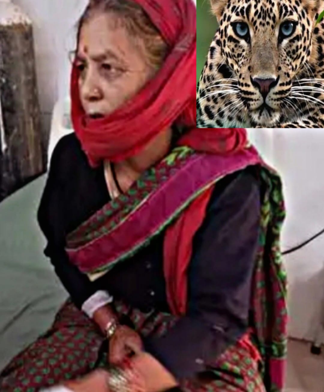 Leopard Menace Escalates in Uttarakhand: 65-Year-Old Woman Fights Off Attack with Sickle
